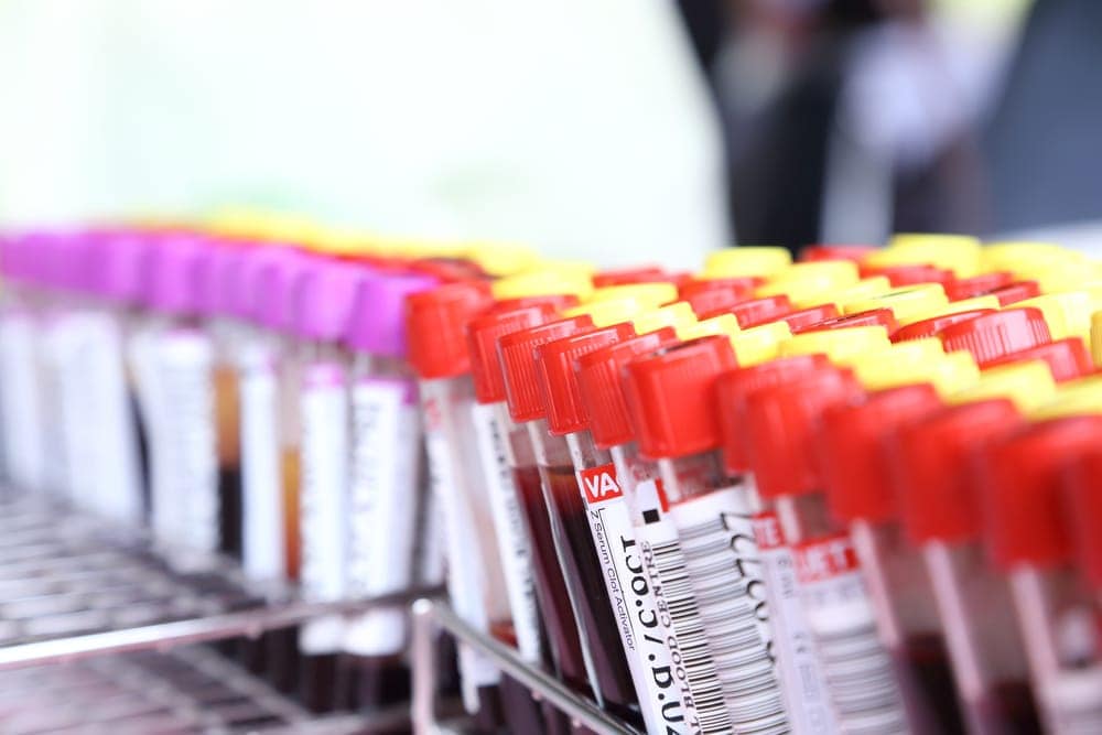 Understanding Pregnancy Blood Tests