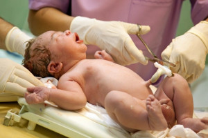 cord-blood-banking-new-born-doctor-cutting-umbilical-cord | American Pregnancy Association