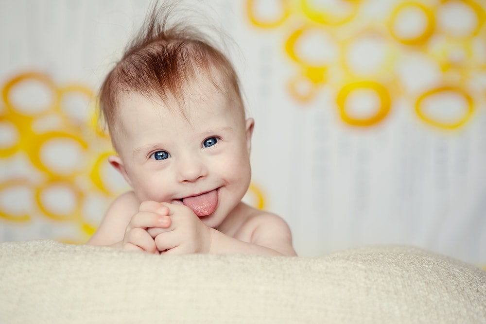 down-syndrome-baby-smiling-tongue-out | American Pregnancy Association