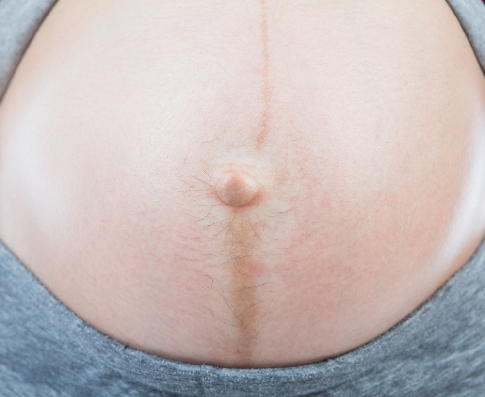 pregnancy-line-nigra-Pregnant-stomach-stretch-mark-belly-button | American Pregnancy Association American Pregnancy Association
