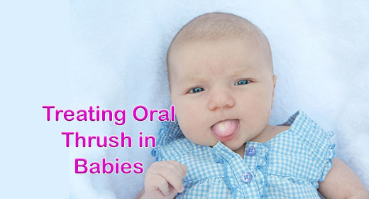 What You Need to Know About Thrush in Babies