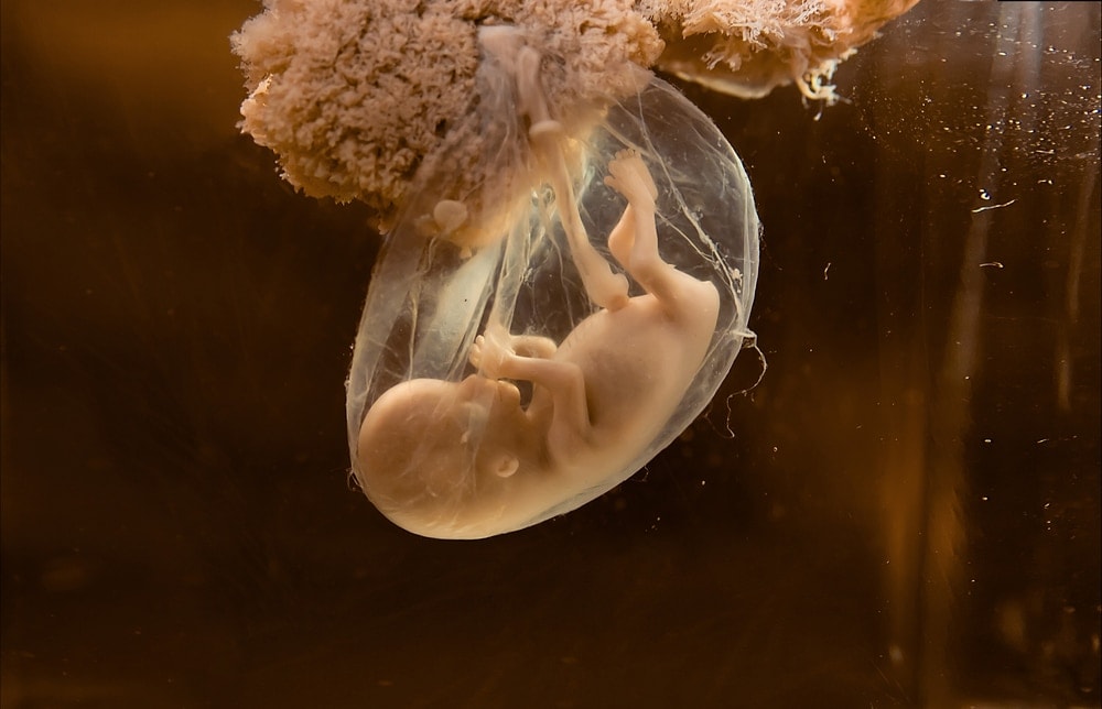 Early Fetal Development
